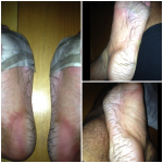 pretty death race feet post death race feet damage